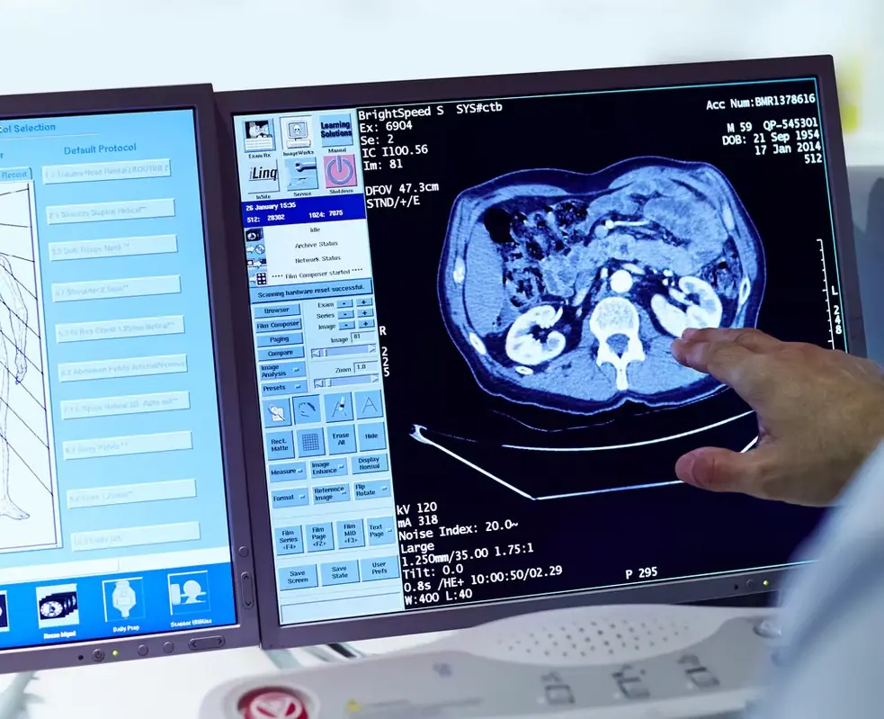 A radiologist pointing at a CT image of the abdomen on a monitor